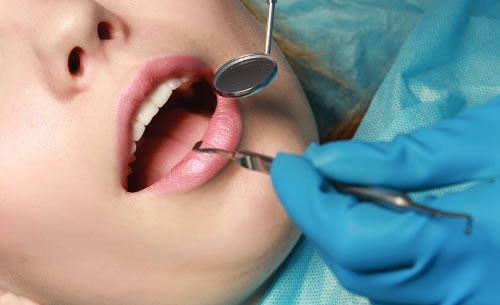 Sedation Service